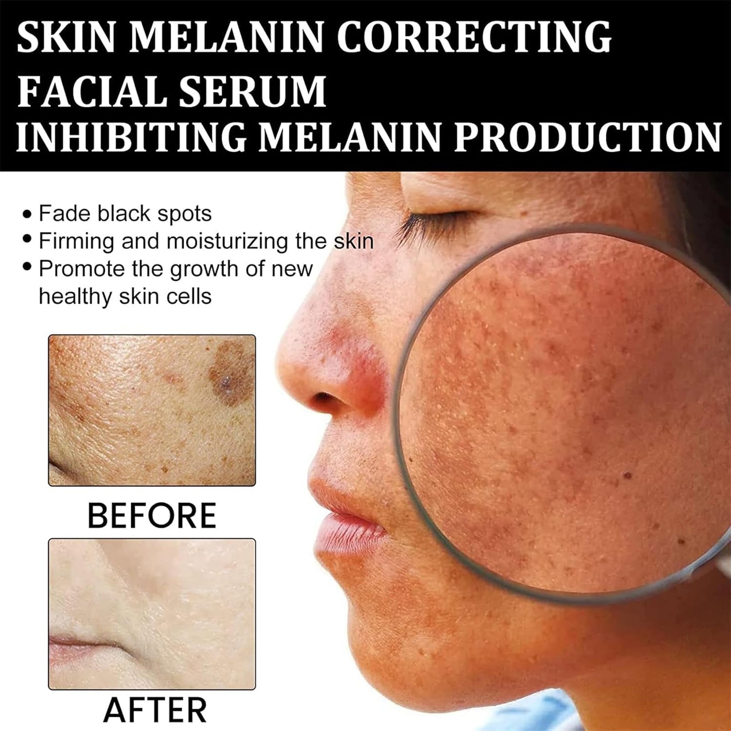 Eelhoe - Melanin Correcting Serum